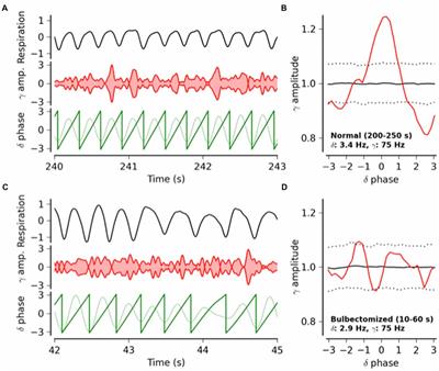 Breathing as a Fundamental Rhythm of Brain Function